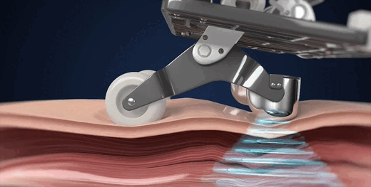 masssage sóng âm tế bào giảm đau nhức