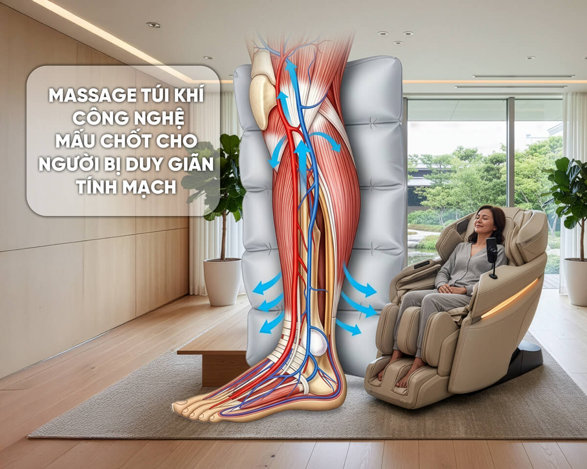massage túi khí giúp hỗ trợ điều trị suy giãn tĩnh mạch - suy giảm tĩnh mạch