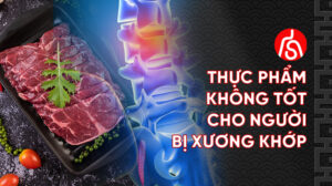 thực phẩm không tốt cho người mắc bệnh xương khớp