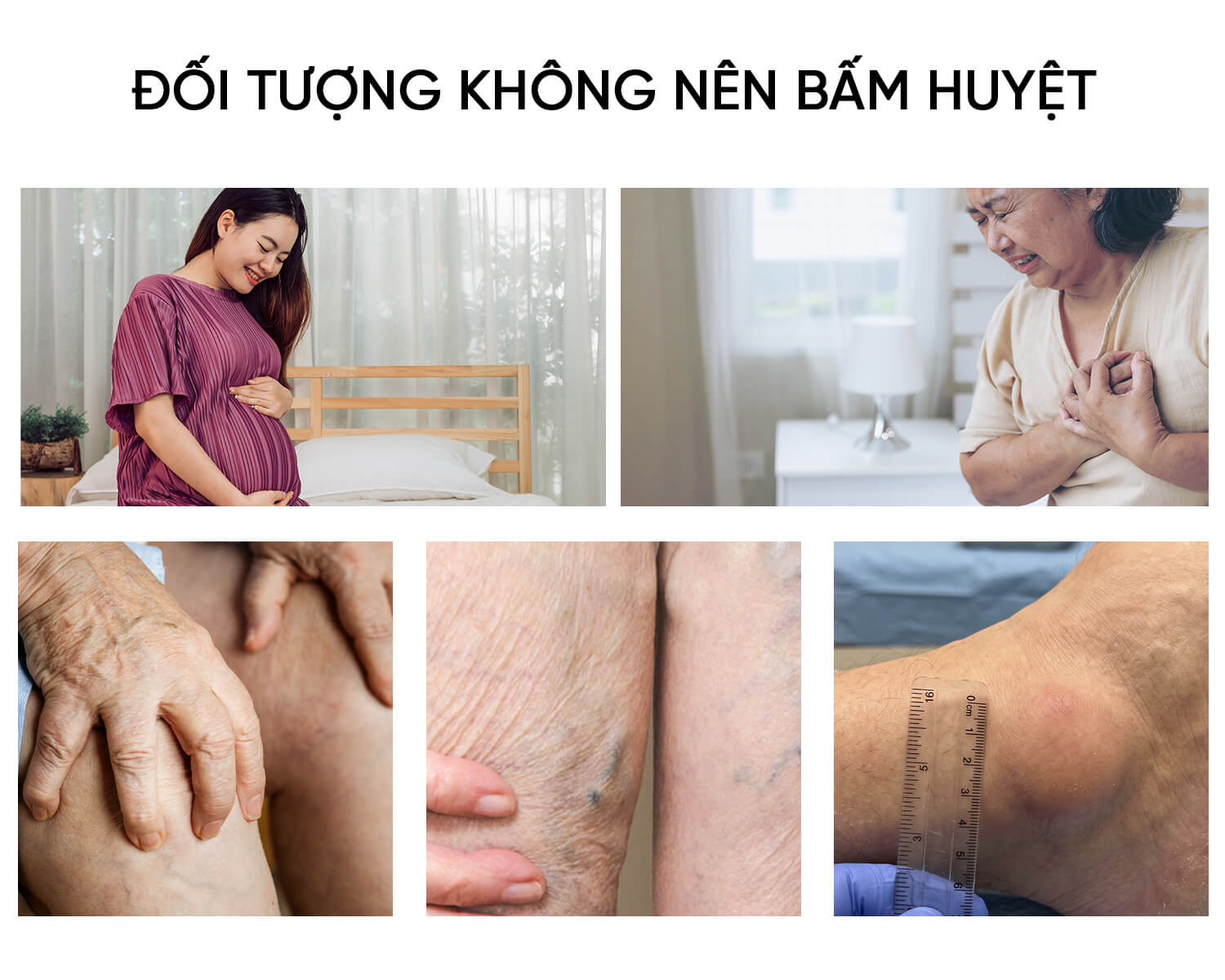 5 ĐỐI TƯỢNG TUYỆT ĐỐI KHÔNG NÊN SỬ DỤNG PHƯƠNG PHÁP BẤM HUYỆT